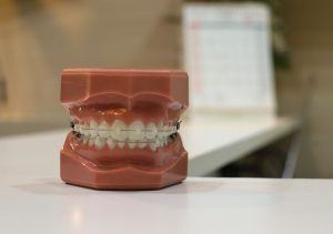 5 orthodontic myths that need to die