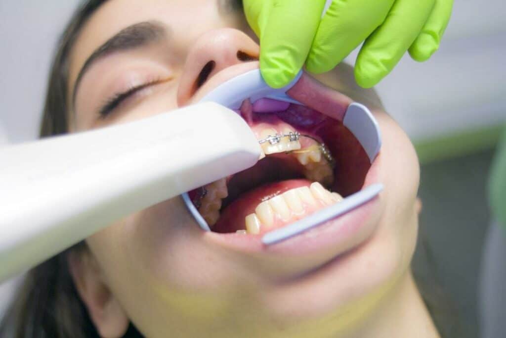 do braces make your teeth stronger